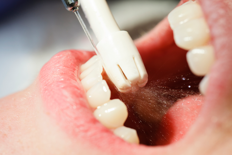 rinsing-teeth-mouth
