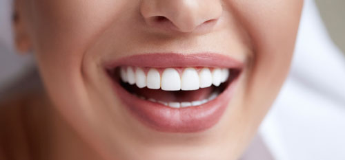 Teeth-Whitening
