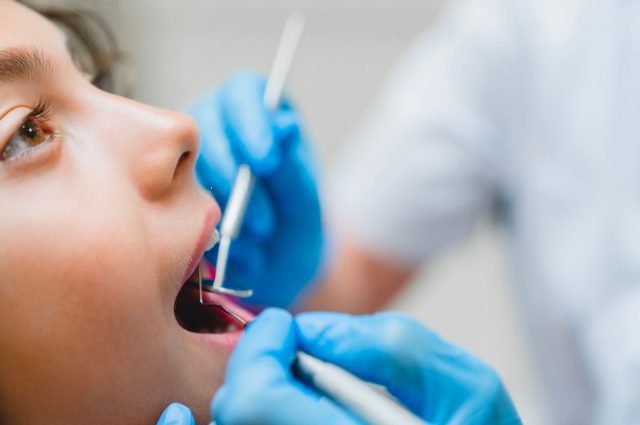 ways to prevent tooth decay in children