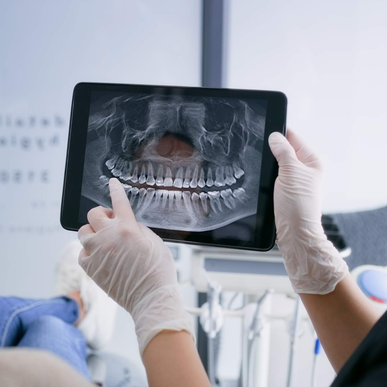cavity-xray